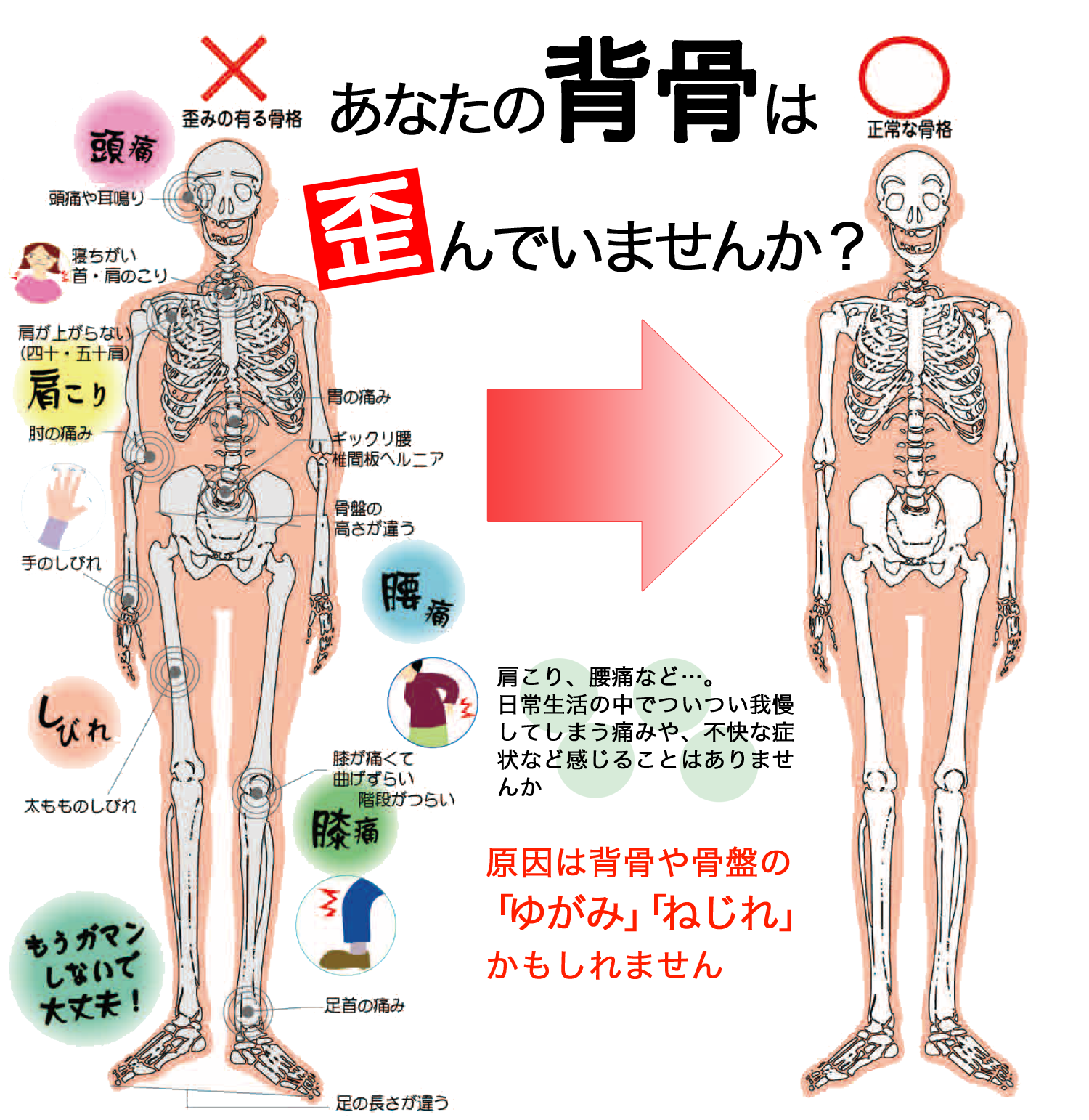 あなたの背骨は歪んでいませんか？